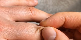 Doktorica podijelila jednostavan trik koji otkriva pijete li dovoljno vode