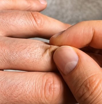 Doktorica podijelila jednostavan trik koji otkriva pijete li dovoljno vode